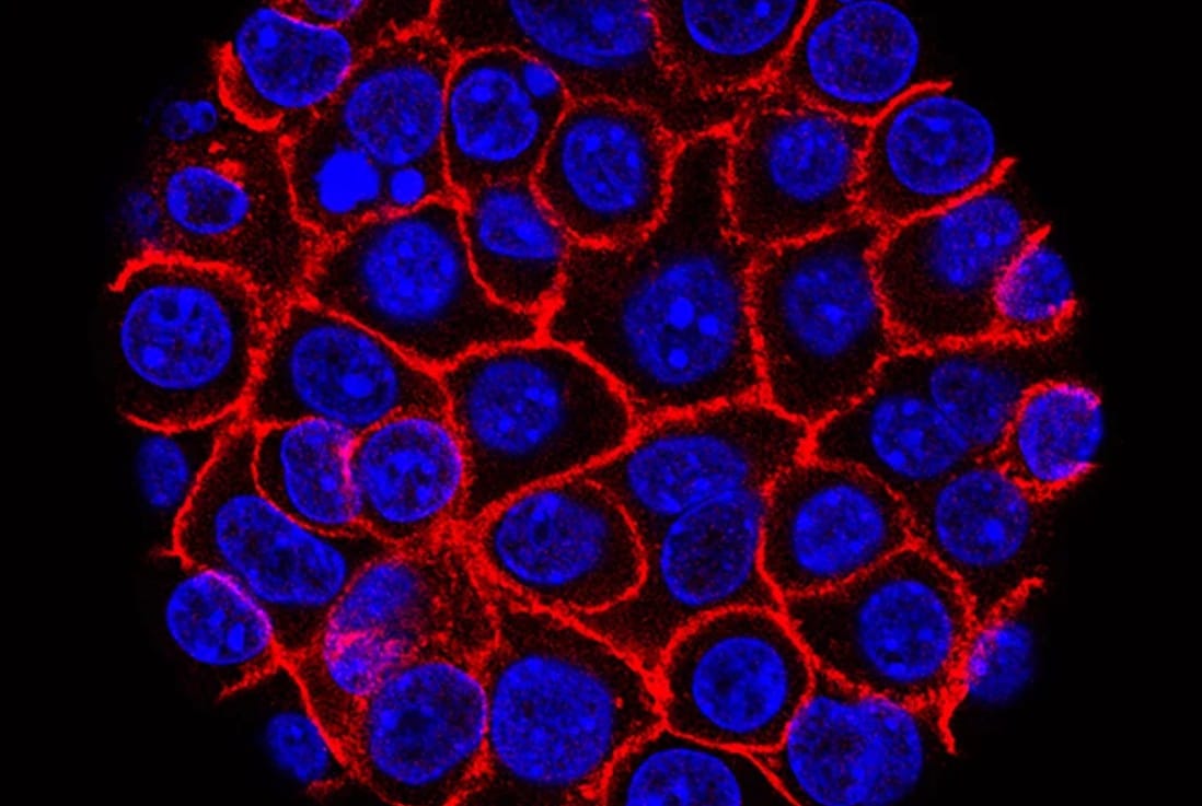 Experimental pill vs deadly pancreatic cancer reduces risk of death by 60%: report